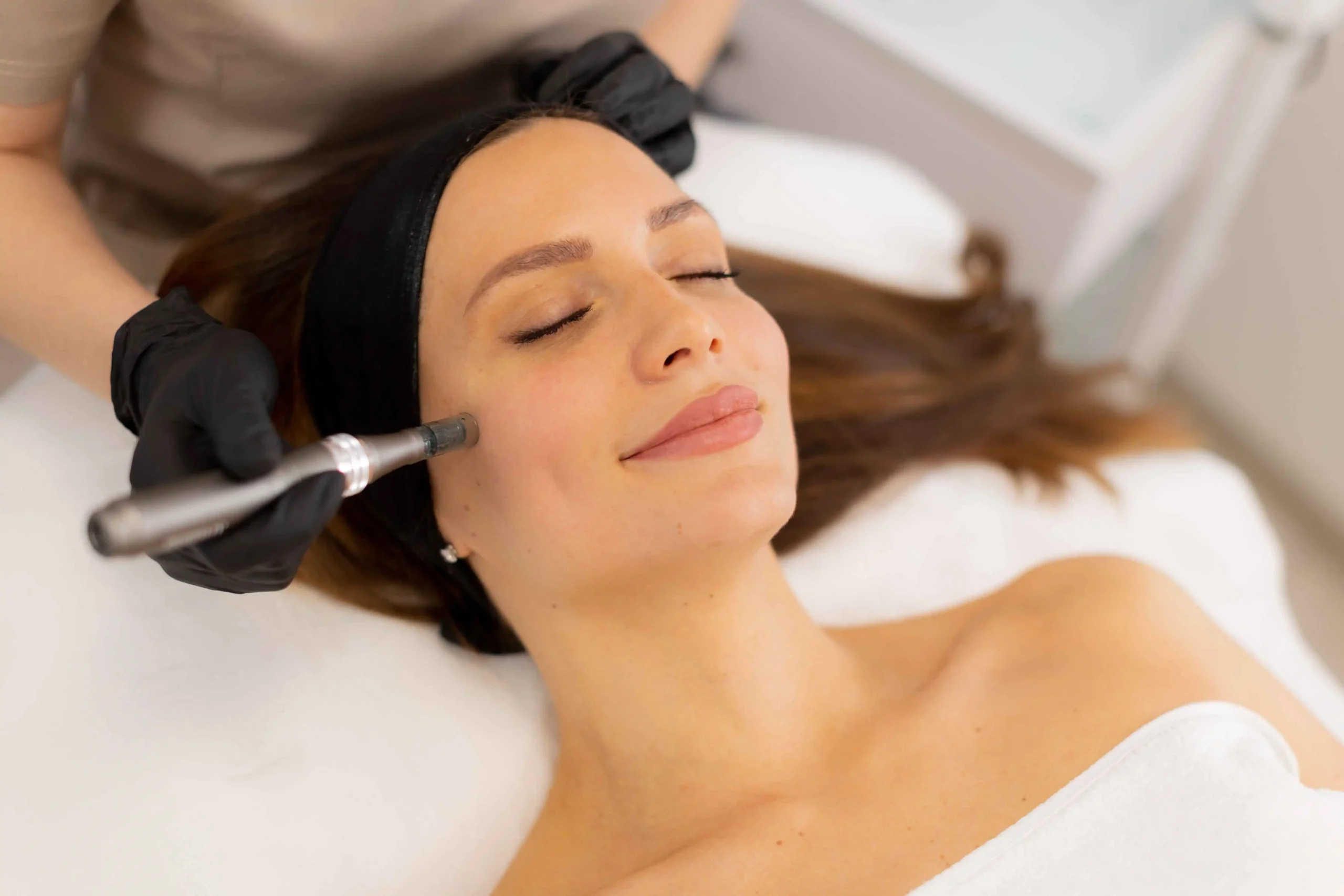 PRP Microneedling